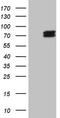 5'-Aminolevulinate Synthase 1 antibody, TA808177, Origene, Western Blot image 