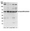 Aspartyl-tRNA synthetase, cytoplasmic antibody, A304-799A, Bethyl Labs, Western Blot image 