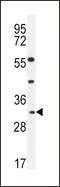 Apolipoprotein F antibody, LS-C156422, Lifespan Biosciences, Western Blot image 