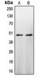 Caspase 9 antibody, LS-C351940, Lifespan Biosciences, Western Blot image 