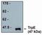 Recombinant TrpE protein antibody, MA1-12688, Invitrogen Antibodies, Western Blot image 