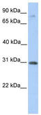Abhydrolase Domain Containing 13 antibody, TA339636, Origene, Western Blot image 