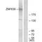 Zinc Finger Protein 638 antibody, A08655, Boster Biological Technology, Western Blot image 