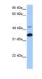Ankyrin Repeat Domain 65 antibody, orb325366, Biorbyt, Western Blot image 
