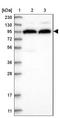 TOG Array Regulator Of Axonemal Microtubules 2 antibody, NBP1-93765, Novus Biologicals, Western Blot image 