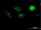 Aurora kinase A-interacting protein antibody, H00054998-B01P, Novus Biologicals, Immunocytochemistry image 