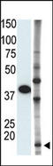 Small Ubiquitin Like Modifier 2 antibody, AP11277PU-N, Origene, Western Blot image 