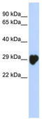 CA1 antibody, TA344346, Origene, Western Blot image 