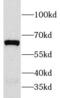 Corticotropin Releasing Hormone Receptor 1 antibody, FNab01974, FineTest, Western Blot image 