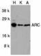 Nucleolar protein 3 antibody, A03991, Boster Biological Technology, Western Blot image 