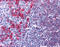 CD79a antibody, 51-562, ProSci, Immunohistochemistry paraffin image 