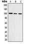 DNA Topoisomerase III Beta antibody, orb214844, Biorbyt, Western Blot image 
