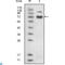 Ephrin type-B receptor 4 antibody, LS-C812372, Lifespan Biosciences, Immunofluorescence image 