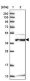 Chromosome 6 Open Reading Frame 47 antibody, PA5-60971, Invitrogen Antibodies, Western Blot image 
