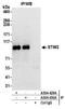 Stromal interaction molecule 2 antibody, A304-429A, Bethyl Labs, Immunoprecipitation image 