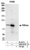 Polyribonucleotide Nucleotidyltransferase 1 antibody, A303-917A, Bethyl Labs, Immunoprecipitation image 