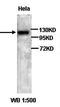 Serine Palmitoyltransferase Long Chain Base Subunit 1 antibody, orb77293, Biorbyt, Western Blot image 