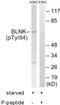 BLNK antibody, PA1-26639, Invitrogen Antibodies, Western Blot image 