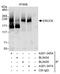 ERCC Excision Repair 6, Chromatin Remodeling Factor antibody, A301-347A, Bethyl Labs, Immunoprecipitation image 