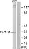 Olfactory Receptor Family 1 Subfamily B Member 1 (Gene/Pseudogene) antibody, TA316380, Origene, Western Blot image 