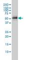 Parkin RBR E3 Ubiquitin Protein Ligase antibody, MCA3315Z, Bio-Rad (formerly AbD Serotec) , Western Blot image 