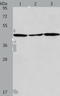 3-ketoacyl-CoA thiolase, mitochondrial antibody, TA321746, Origene, Western Blot image 
