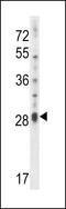 Interleukin 17D antibody, 57-908, ProSci, Western Blot image 