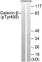 Catenin Beta 1 antibody, PA5-39715, Invitrogen Antibodies, Western Blot image 