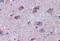 Fragile X Mental Retardation 1 antibody, MBS244746, MyBioSource, Immunohistochemistry paraffin image 