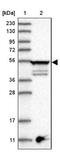 Tubulin Epsilon 1 antibody, NBP1-85205, Novus Biologicals, Western Blot image 