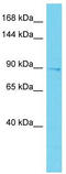 Epidermal Growth Factor Receptor Pathway Substrate 15 Like 1 antibody, TA331793, Origene, Western Blot image 