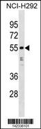 Heterogeneous nuclear ribonucleoprotein H antibody, 60-849, ProSci, Western Blot image 