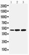 SMAD Family Member 7 antibody, PA1954, Boster Biological Technology, Western Blot image 