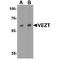 Vezatin, Adherens Junctions Transmembrane Protein antibody, TA349097, Origene, Western Blot image 