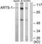 Endoplasmic Reticulum Aminopeptidase 1 antibody, TA315501, Origene, Western Blot image 