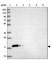 Calmodulin Like 3 antibody, HPA044999, Atlas Antibodies, Western Blot image 