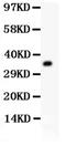 Receptor For Activated C Kinase 1 antibody, PA5-79319, Invitrogen Antibodies, Western Blot image 