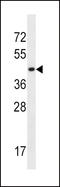 Monocarboxylate transporter 10 antibody, LS-C161136, Lifespan Biosciences, Western Blot image 