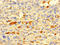 Interferon Alpha Inducible Protein 27 Like 2 antibody, LS-C379978, Lifespan Biosciences, Immunohistochemistry paraffin image 