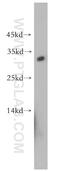 Dickkopf WNT Signaling Pathway Inhibitor 2 antibody, 21051-1-AP, Proteintech Group, Western Blot image 