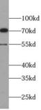 Matrix Metallopeptidase 13 antibody, FNab05235, FineTest, Western Blot image 