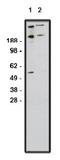 GLI Family Zinc Finger 1 antibody, AP05303PU-N, Origene, Western Blot image 