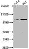 Protein Kinase N3 antibody, CSB-PA744059LA01HU, Cusabio, Western Blot image 