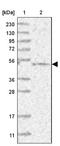 Centrosomal Protein 70 antibody, NBP1-88593, Novus Biologicals, Western Blot image 