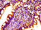Norrin Cystine Knot Growth Factor NDP antibody, LS-C670834, Lifespan Biosciences, Immunohistochemistry paraffin image 