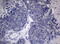 Homeobox D4 antibody, M09189, Boster Biological Technology, Immunohistochemistry paraffin image 