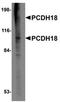 Protocadherin 18 antibody, orb75165, Biorbyt, Western Blot image 