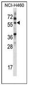 Multiple Inositol-Polyphosphate Phosphatase 1 antibody, AP52699PU-N, Origene, Western Blot image 