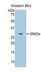 CD40 Ligand antibody, LS-C697560, Lifespan Biosciences, Western Blot image 