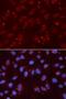 DNA repair protein XRCC3 antibody, LS-C331928, Lifespan Biosciences, Immunofluorescence image 
